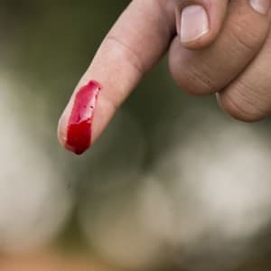 bleed