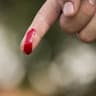 bleed
