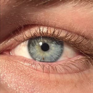 genetic